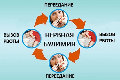 Лечение булимии в Мамадыше